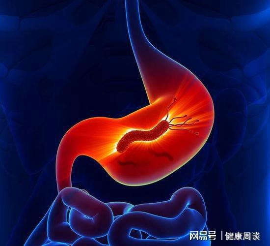 被忽视的“胃病祸首”！医生揭秘四种食物远离胃痛只需舍弃它们(图3)